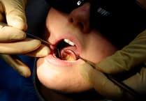 Dozens of hospital admissions in South Hams to remove children's rotten teeth