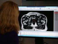 More men diagnosed with prostate cancer in Devon