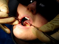 Children in South Hams have highest rate of rotting teeth in the South West