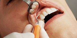 Devon's dental van plan halted