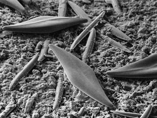 Nature Diary by Nigel Mortimer | Healthy Estuarine Scum?!
